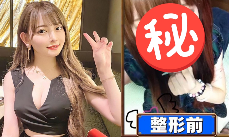 从丑小鸭到人气KOL！日本16岁千金逆袭之路：遭男友嫌丑、家道中落欠巨债，打工狂赚1500万整容翻身 - 偶像便利店